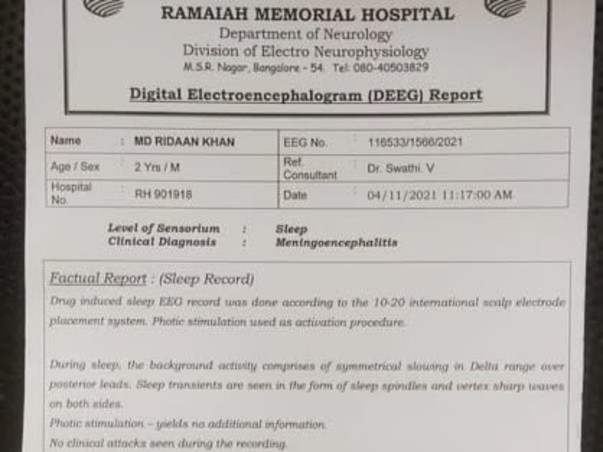 2 years Old Mohammad  Ridaan Khan Needs Your Help To Recover From  Brain Infection