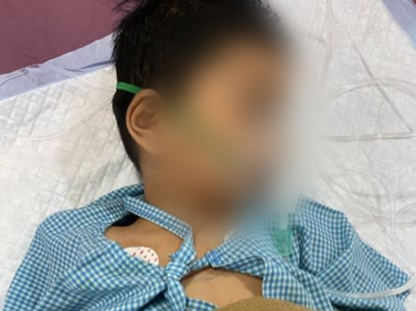 2 years Old Mohammad  Ridaan Khan Needs Your Help To Recover From  Brain Infection