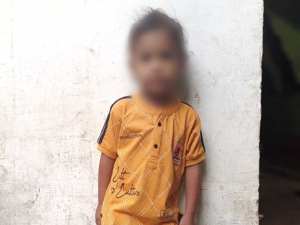 Please Help 3-Year-Old Bishal In His Open-Heart Surgery