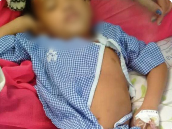 Please Help 3-Year-Old Bishal In His Open-Heart Surgery