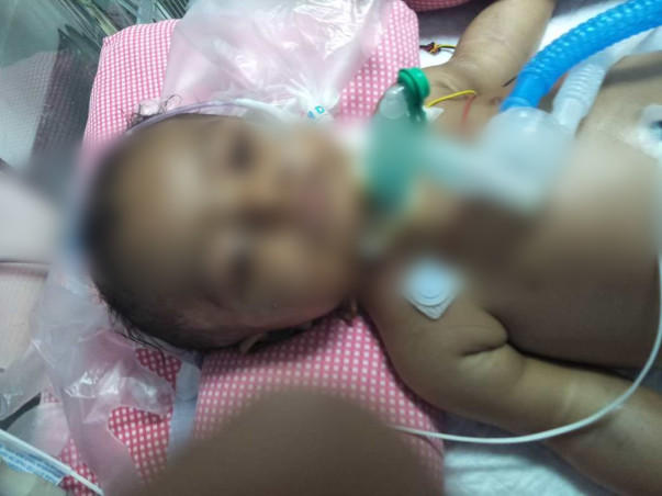 Help My Son To Recover From Lungs Infection And Spinal Muscular Atrophy (SMA)