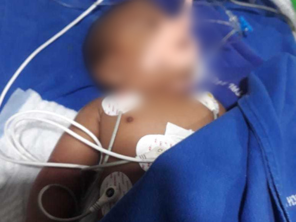 4 months old Shaik Mahi needs your help fight Severe respiratory distress