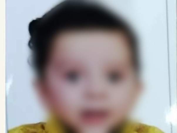 Mohammad Ayman (cochelar Implant Surgery)