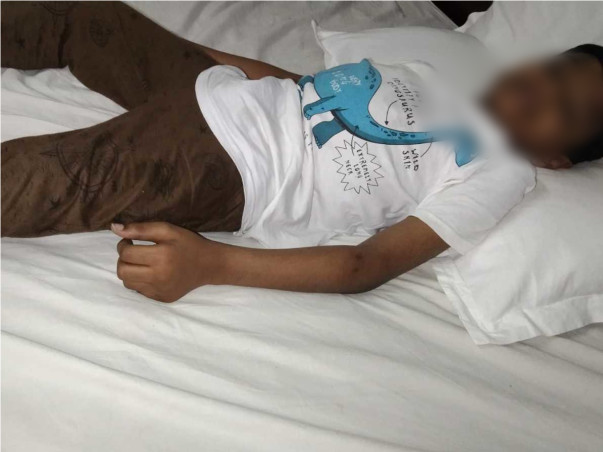 Support Mohith Sai Aman To Recover Spinal Deformity