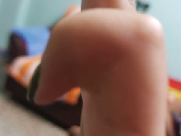 Support Shaik Banu To Recover From Little Finger Injury