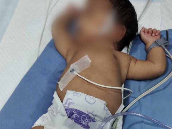 Help New Born Baby To recover from Heart Disease