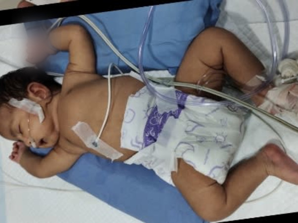 Help New Born Baby To recover from Heart Disease