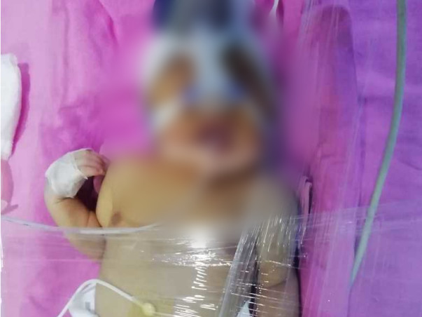 5 Days Old BABY Needs Your Help