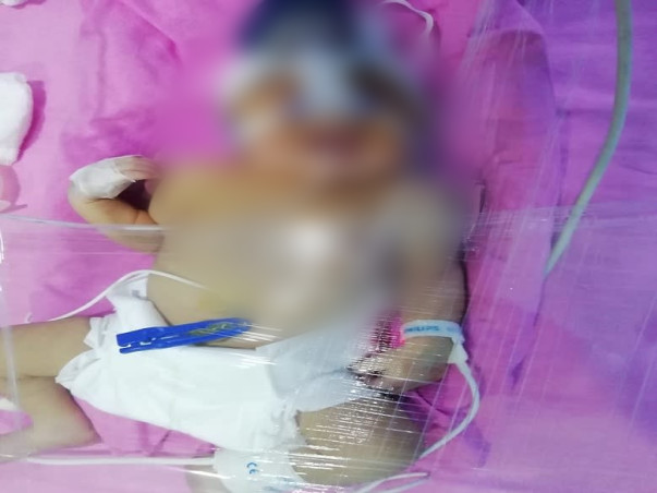 5 Days Old BABY Needs Your Help