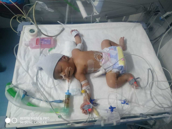 Help New Born Baby Boy To Recover Heart Disease