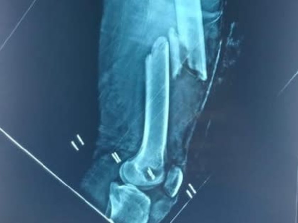 Help Naveen To Walk Again As He Met With Severe Leg Accident