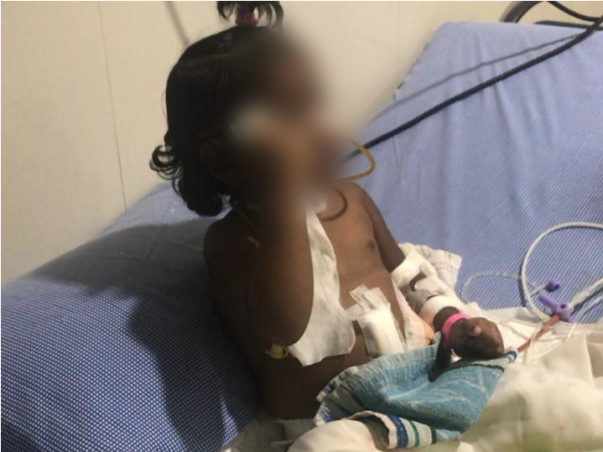 4 Years Old Needs Your Urgent Support In Fighting Corrosive Injury Of Oesophagus