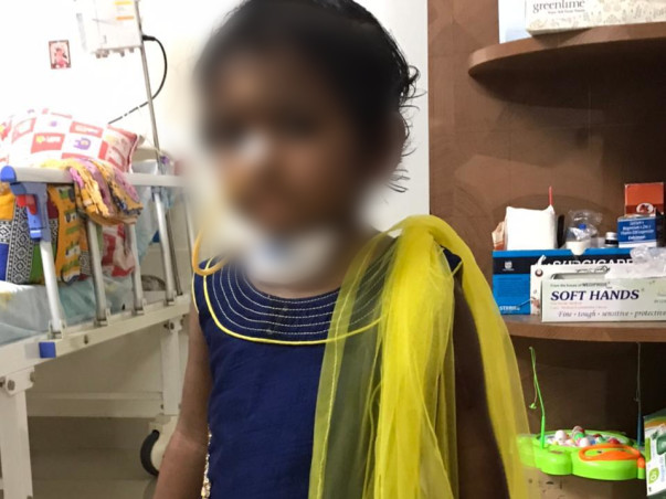 4 Years Old Needs Your Urgent Support In Fighting Corrosive Injury Of Oesophagus
