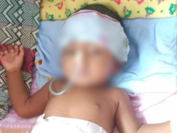 3 months old R Vaivika needs your help fight Kasai Portoenterosoomy ( Liver Damage)
