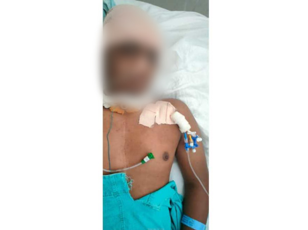 Support Harshavardhan Damineni Recover From Accidental Multiple Injury