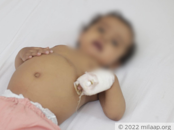 1 Year Old Utkarsh Needs Your Help Fight Liver Transplant