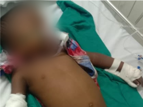 Support Sanjith Recover From B cell Acute lymphoblastic leukemia.