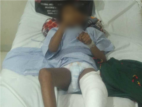 Help Vedant fight Cerebral Palsy