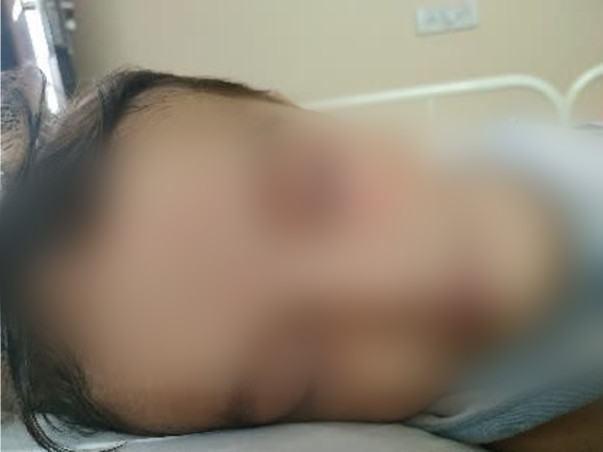 Support Shiwansh Dahal Fight from Juvenile Myelomonocytoc Leukemia