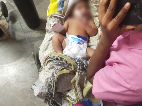 Support Baby of Pavani recover from Cardiac disease