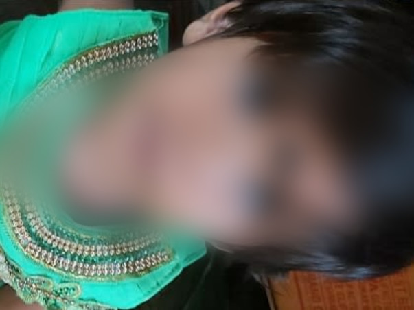 Help My Friend's Daughter Undergo Heart Surgery