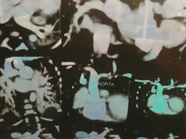 *Help My Baby Boy To Recover Heart Disease*