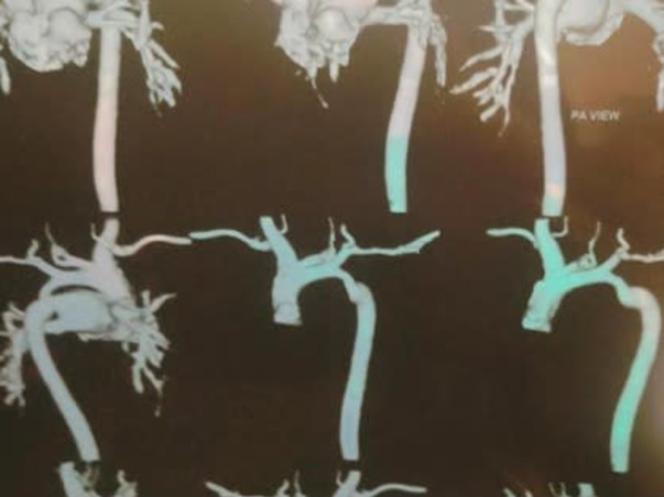 *Help My Baby Boy To Recover Heart Disease*