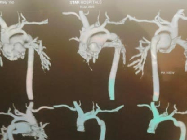 *Help My Baby Boy To Recover Heart Disease*