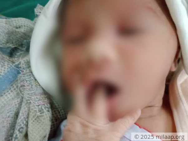 Help My 2 Week Old Son Survive