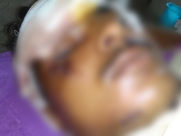 Help Neeraj Recover From An Accident