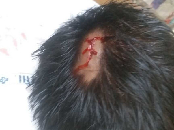 12 years old Sanjay Maharana needs your help fight Traumatic brain injury