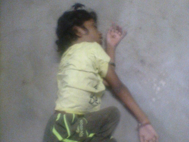 11 Years Old Deepika Needs Your Help Fight Physically Handicapped
