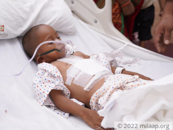 5 years old Aditya Kunal pal needs your help fight VSD