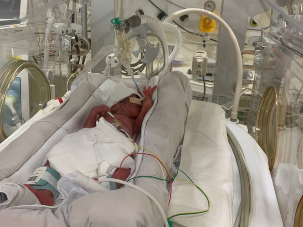 2 monthsOld Baby Ishankrishnan Needs Your Help To Fight PrematureBirth