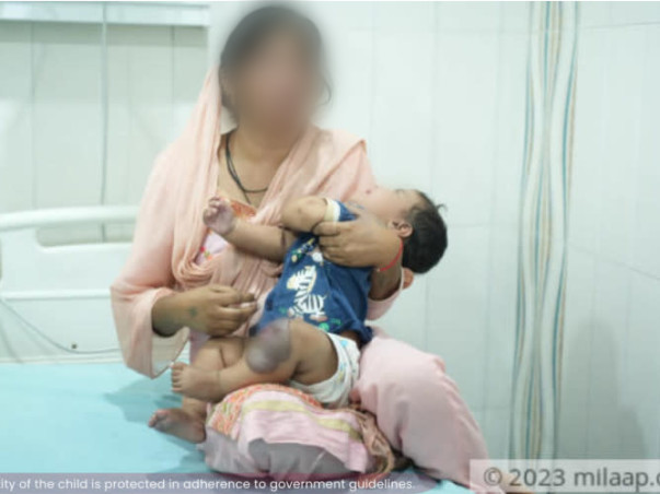 Plastic Surgery Is The Last Resort To Save 8-Month-Old From Leg Tumour