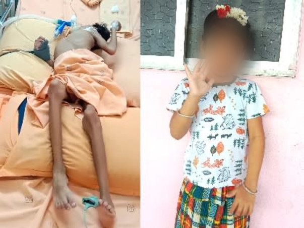 7 Years Old Maha Swetha Needs Your Help To Recover From Brain Fever