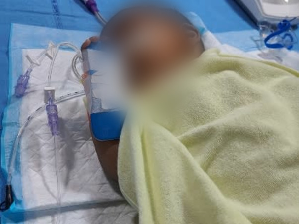 10 months old Sammya Deb Sherpa needs your help fight SMA,type1