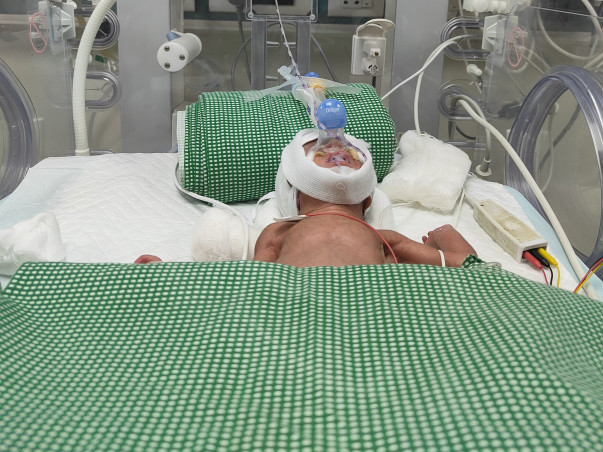 Help my daughter fight Preterm Birth/Preterm Complications