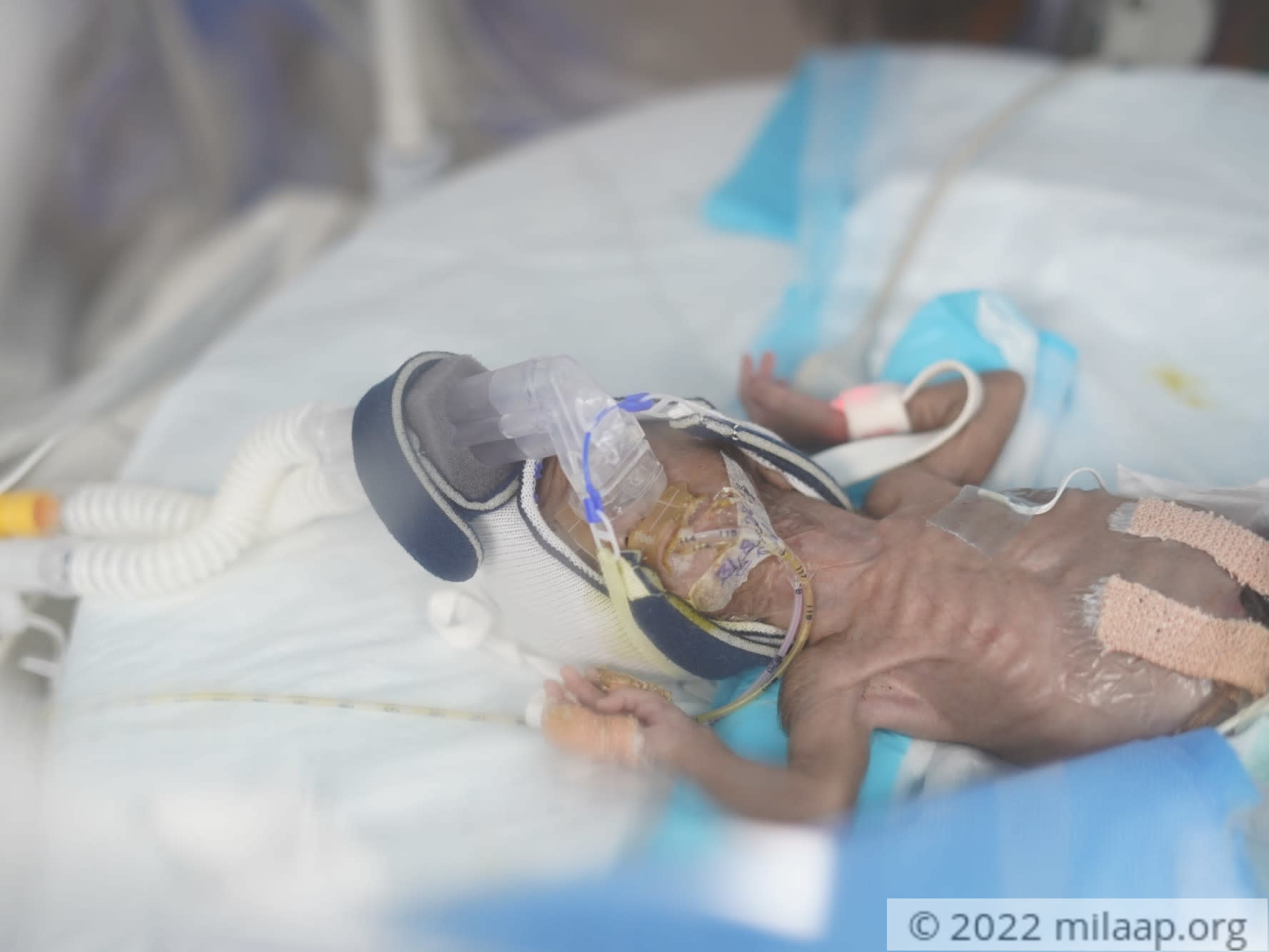 Bmr01924 gec9he 1662098230 lqnclj 1662902086