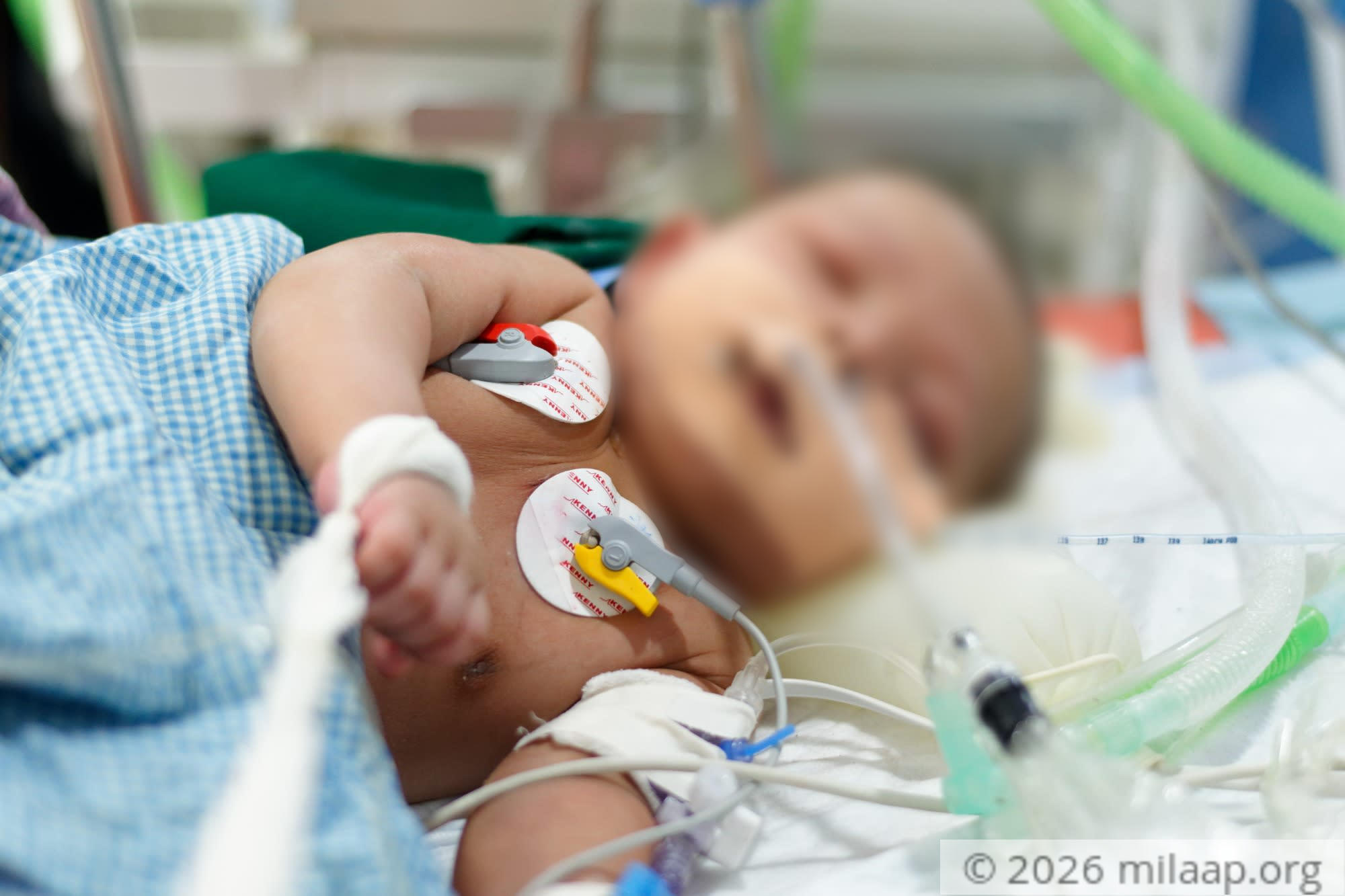 Dsc 1233 dxo kukarl 1572688101