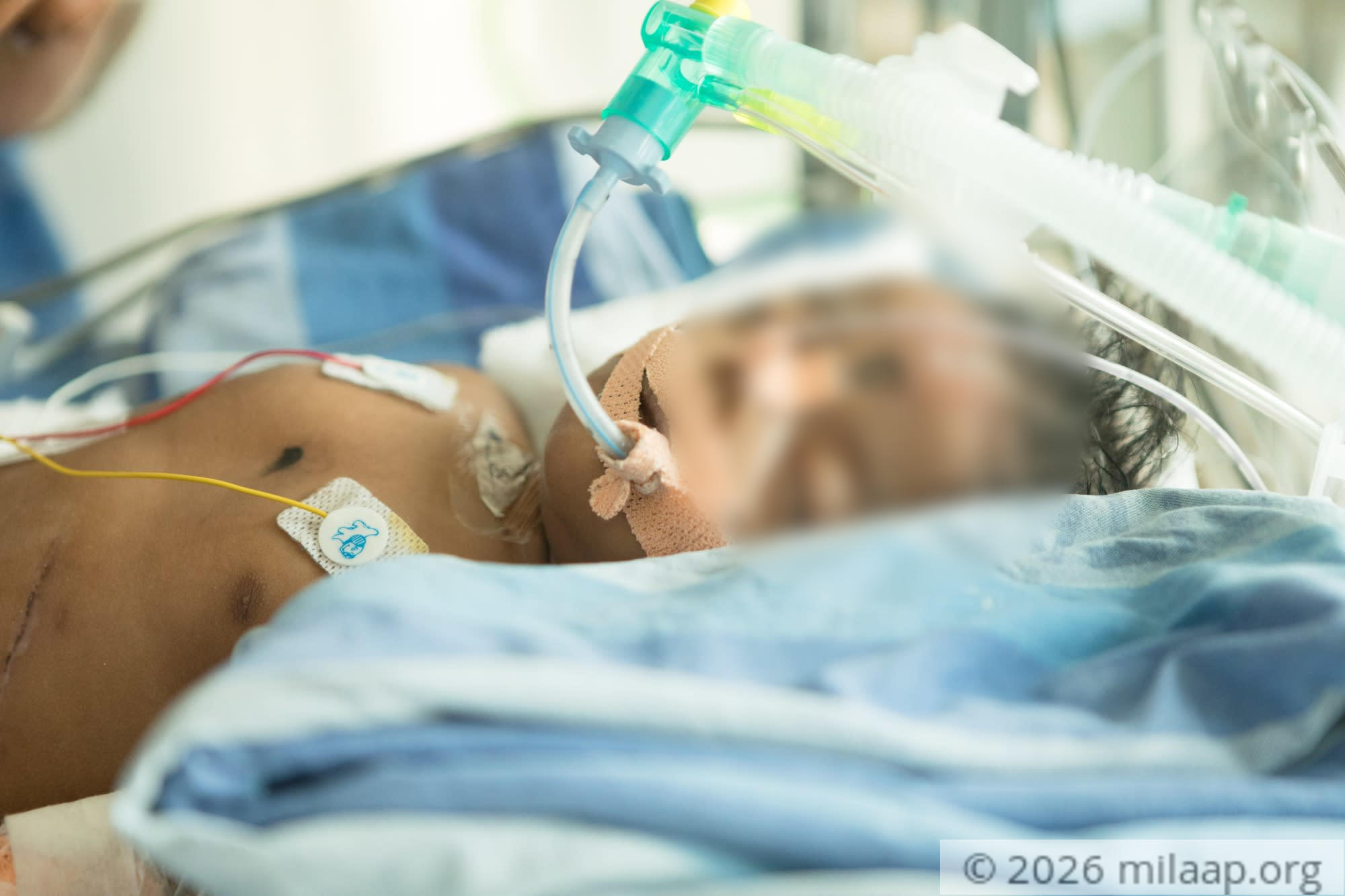 Baby of swathi 9 fmidog 1574681946