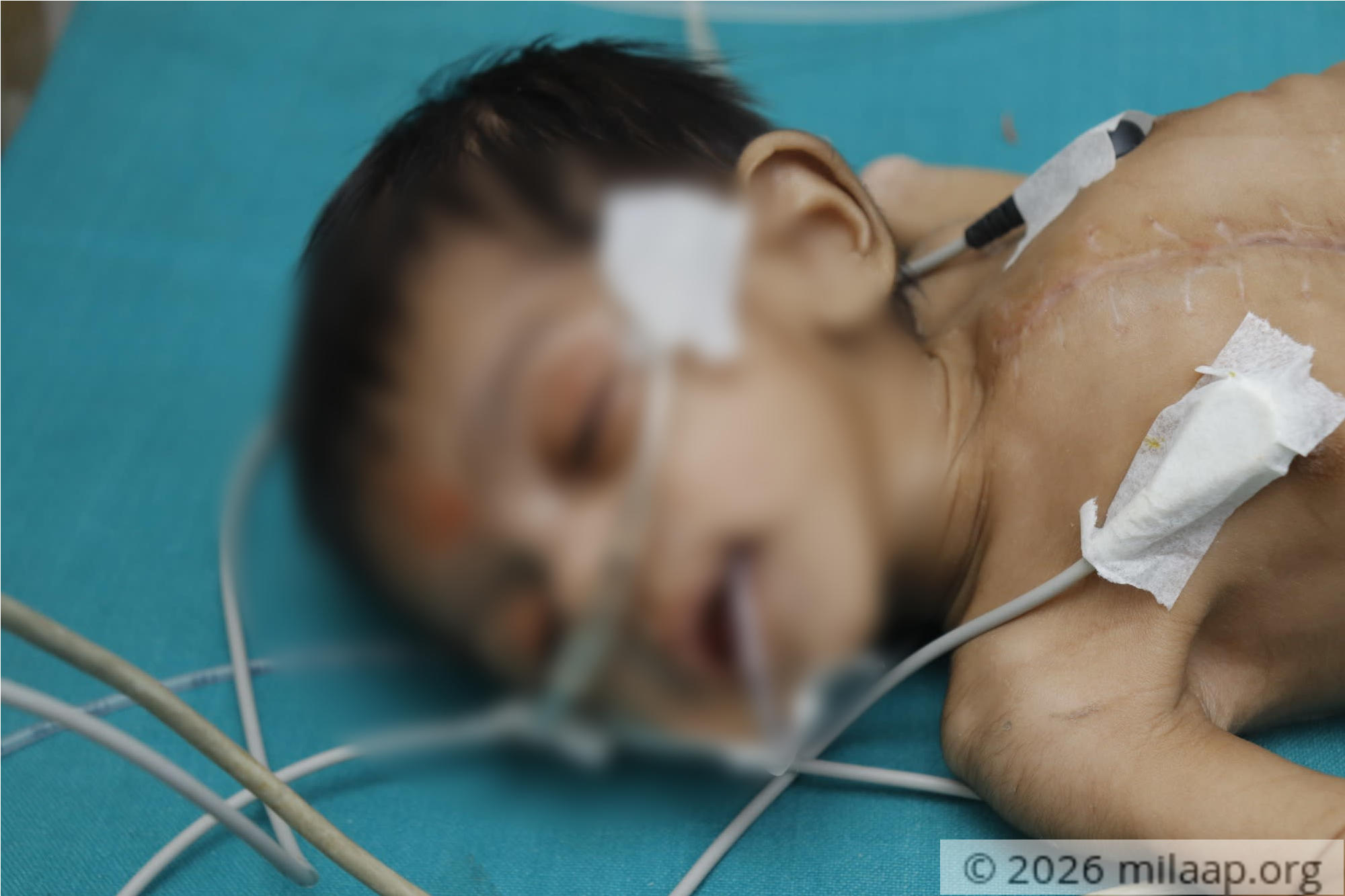  mg 8253 wvmz7i 1576647108