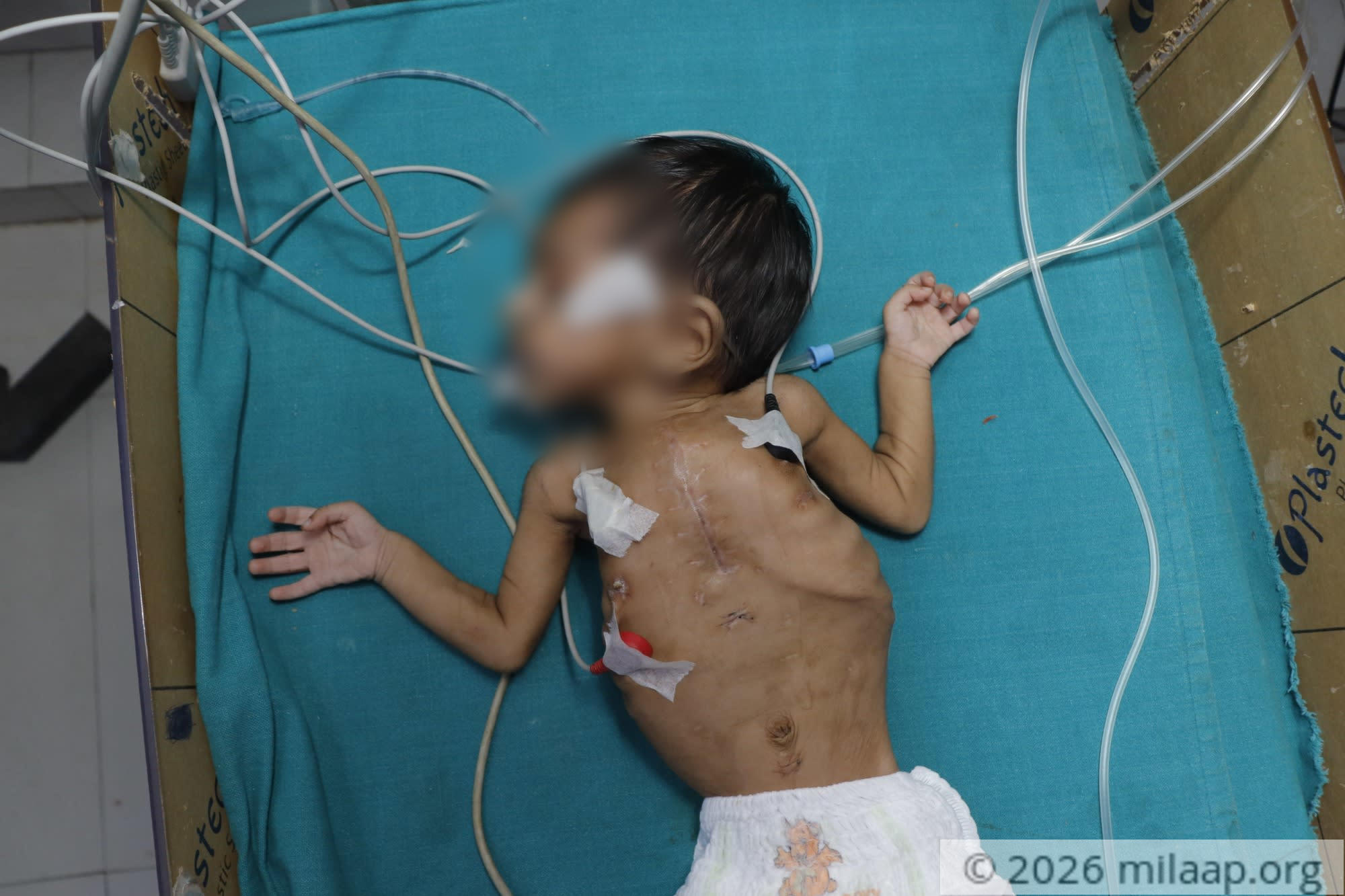  mg 8264 s42kef 1576647126