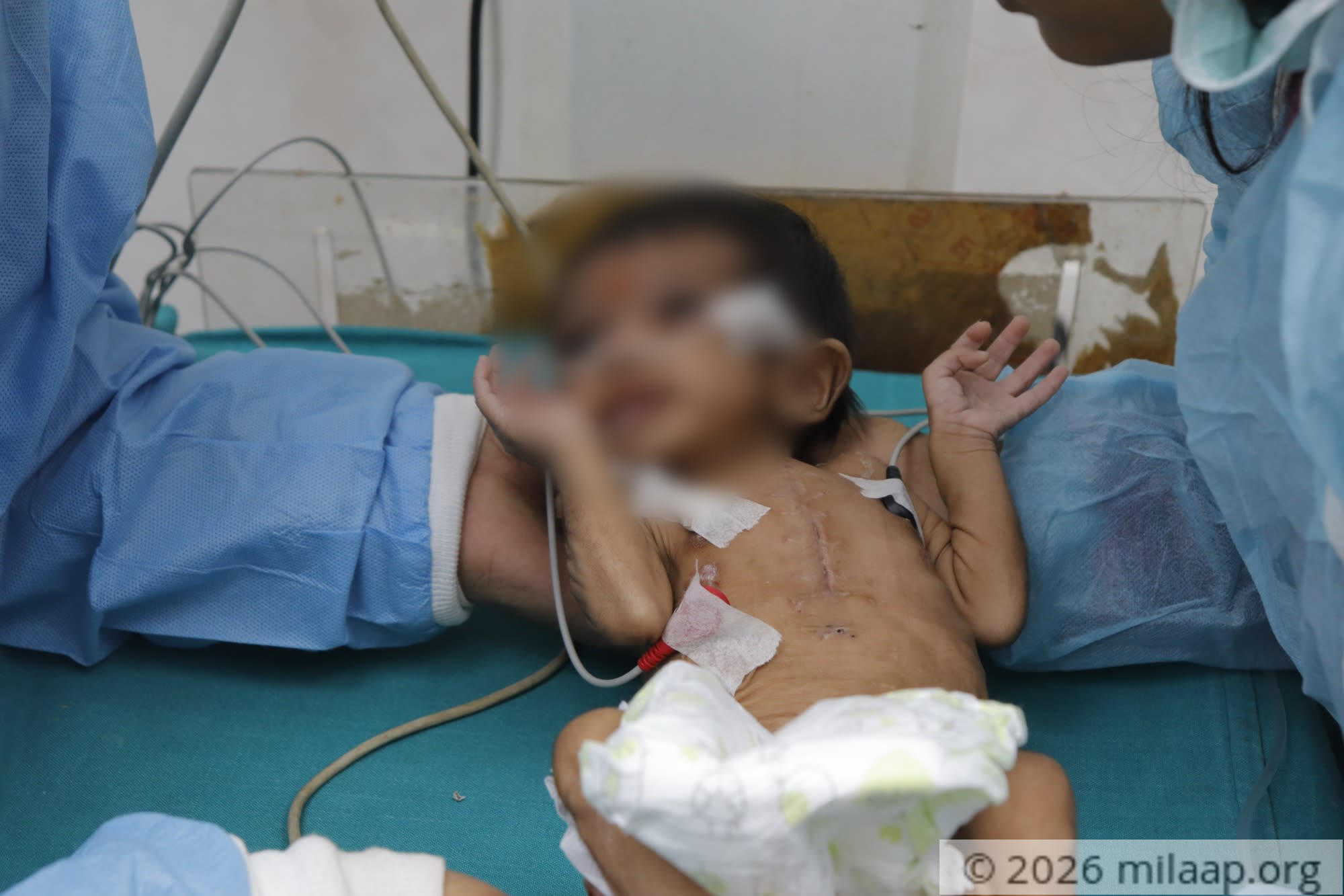  mg 8376 crht5w 1576647337