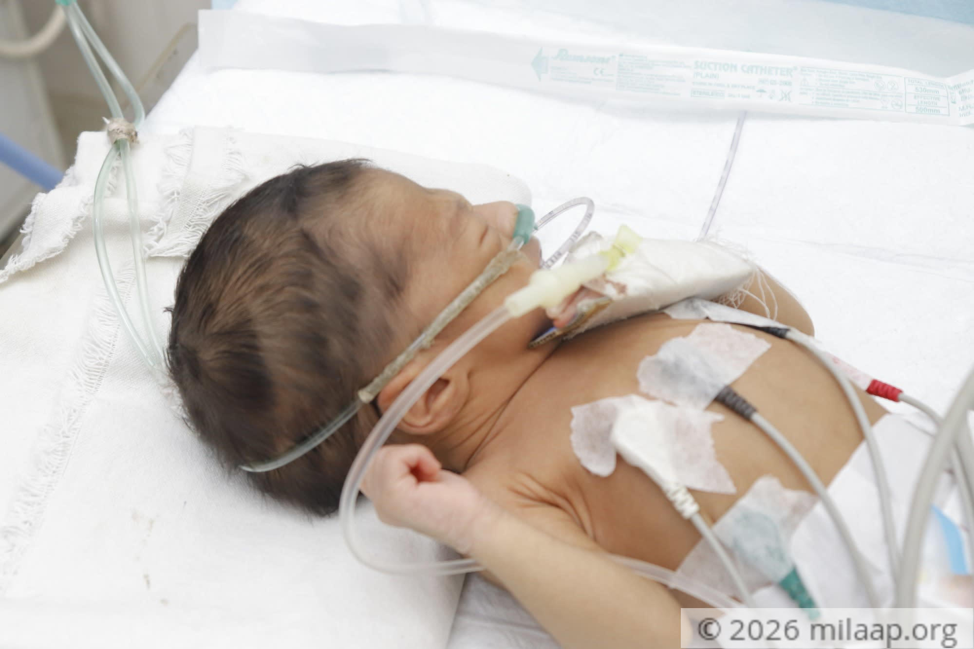  mg 4351 g1sx44 1576920148