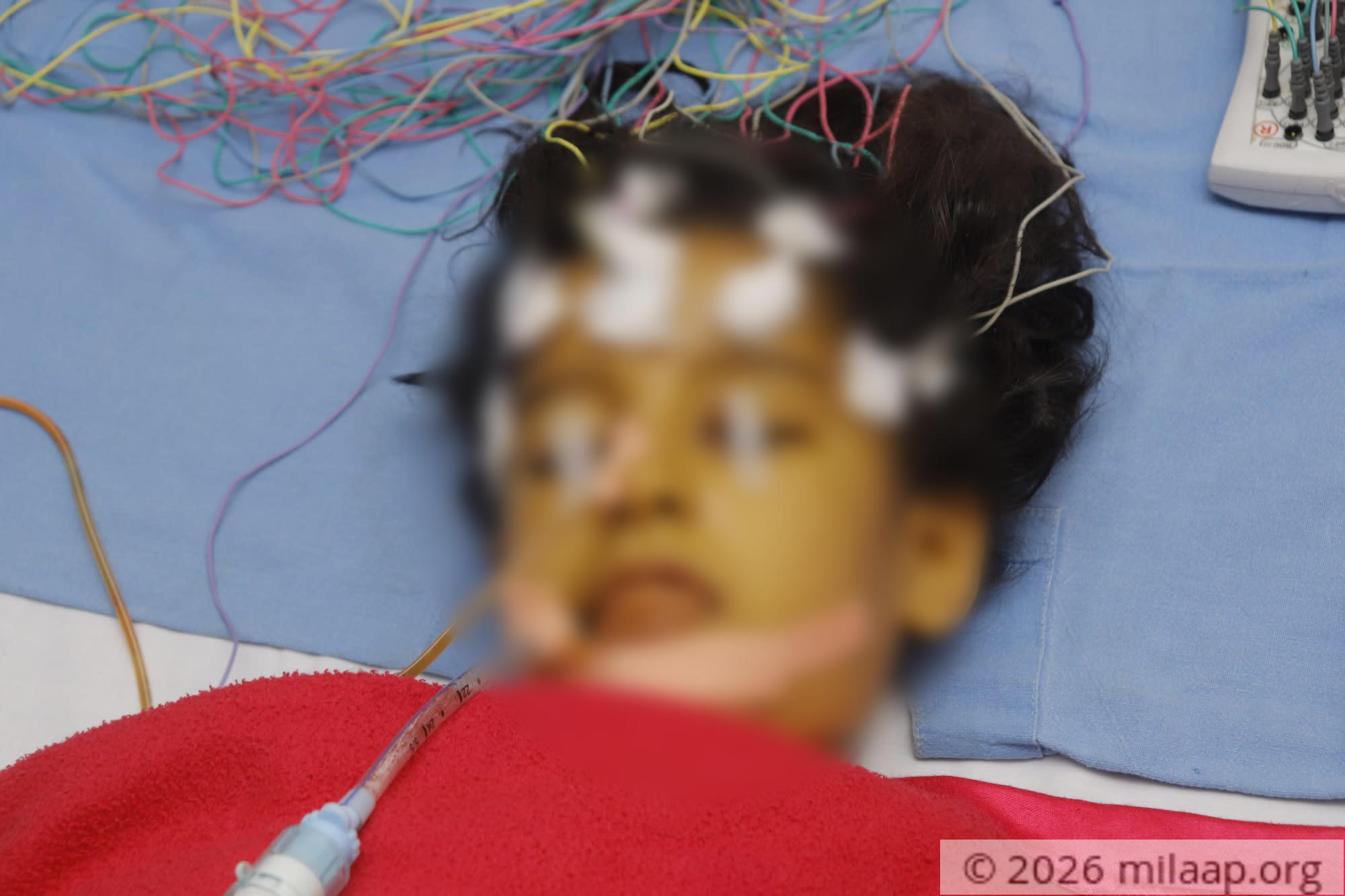  mg 1909 aftwdn 1582604279