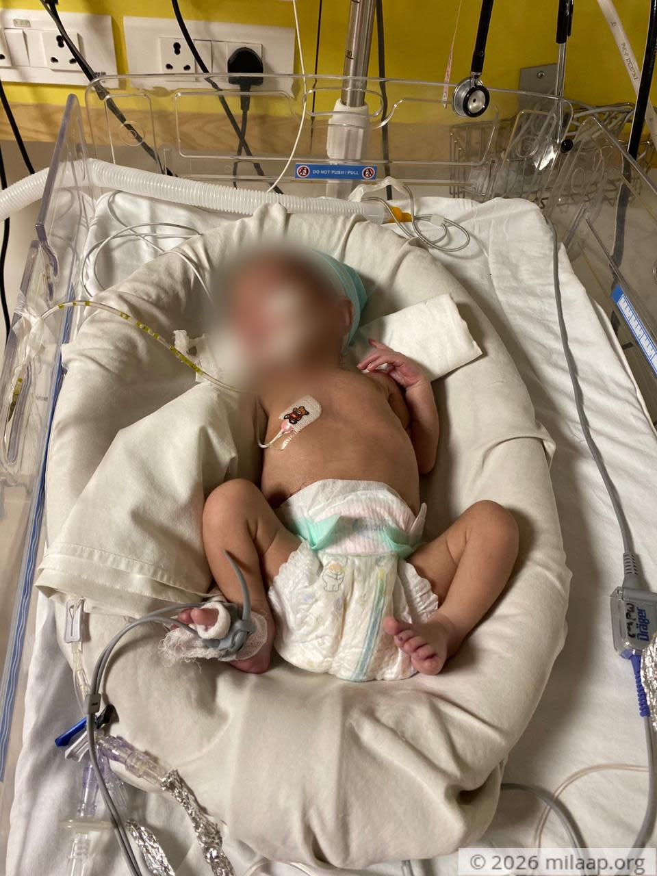 Whatsapp image 2020 07 19 at 3.17.21 pm 1 kmqxw6 1595319141