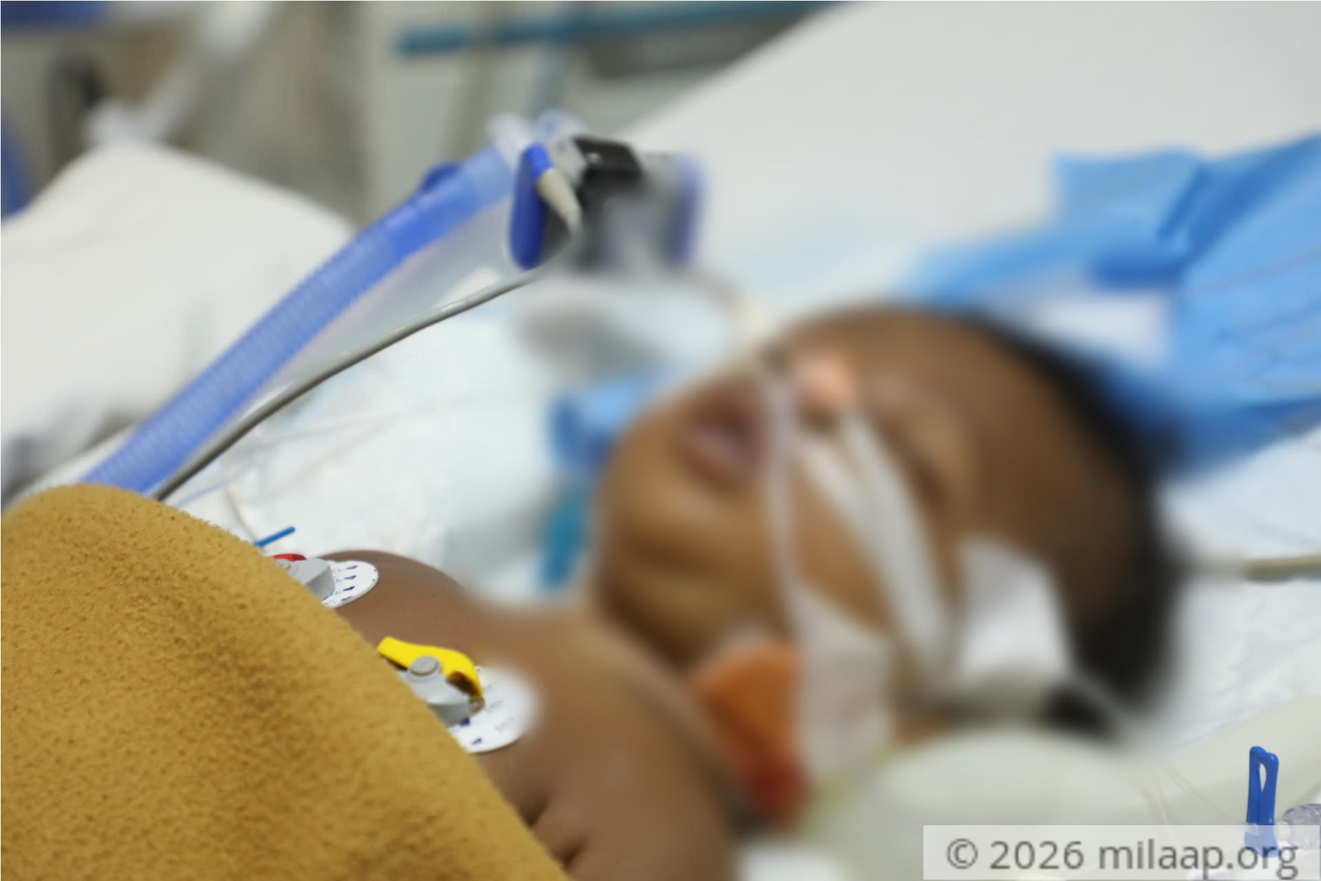 08e99fec f6f5 46e6 9b53 f9a99bf630fb orzmet 1598242902