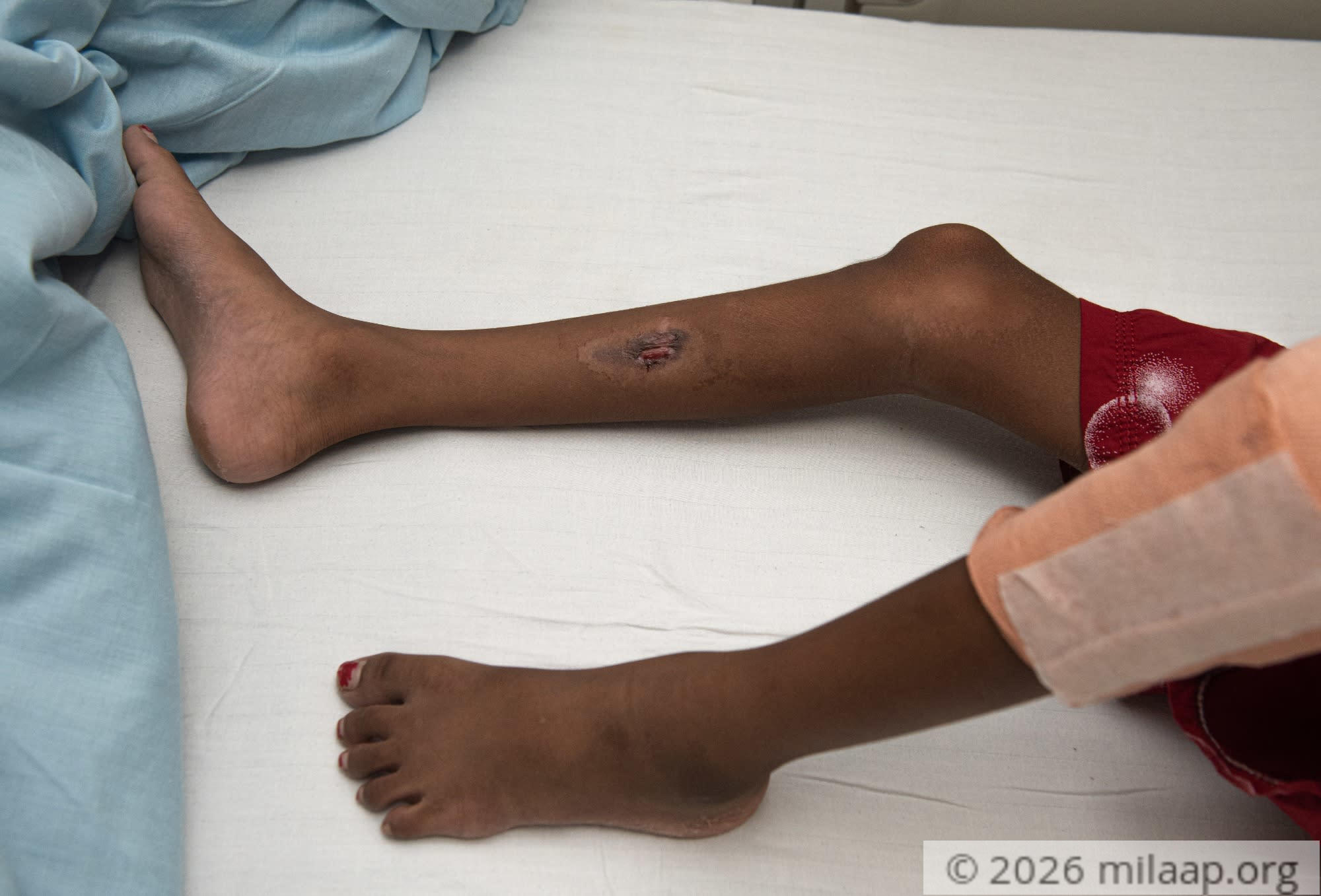 Dev 3757 jwyb8u 1598692561