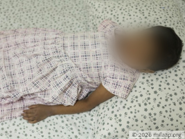 Geetha's Liver Disease Makes Her Scratch Her Skin Till It Bleeds